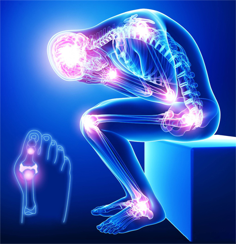 为什么说类风湿性关节炎是‘不死的癌症’？原来真相是这样的