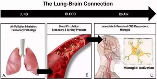 科学研究证实雾霾会进入大脑，造成永久性的伤害